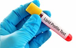 Lipid Profile Test for Pets